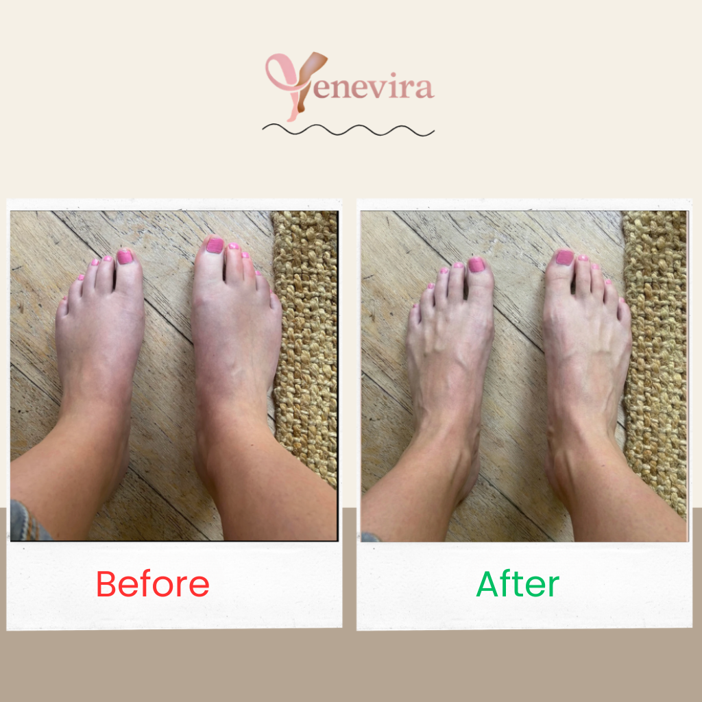Venevira™ Flow Kompression Socken für Breite Waden